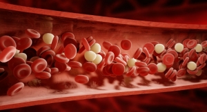 Regenerating Blood Vessels Gets $2.7 Million Grant 