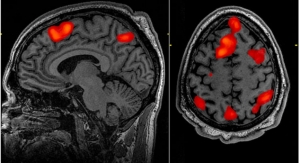 Softwares for fMRI Yield Erroneous Results