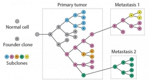 Software Helps Identify Course of Cancer Metastasis, Tumor 