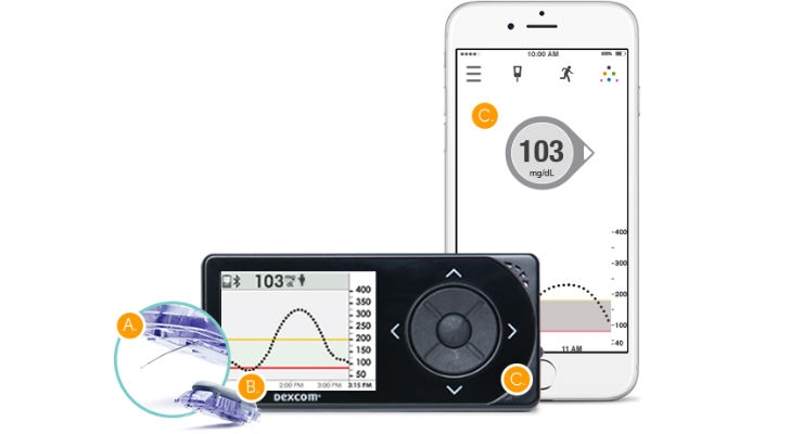 Dexcom G5 Mobile CGM Awarded Expanded Indication to Replace Fingerstick Testing