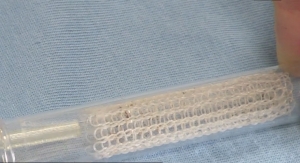 Removable Airway Stent Could Revolutionize Surgery