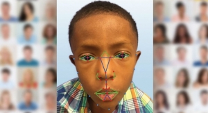 Facial Recognition Software Helps Identify Rare Genetic Disease