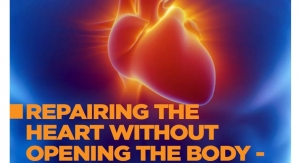 Repairing the Heart Without Opening the Body