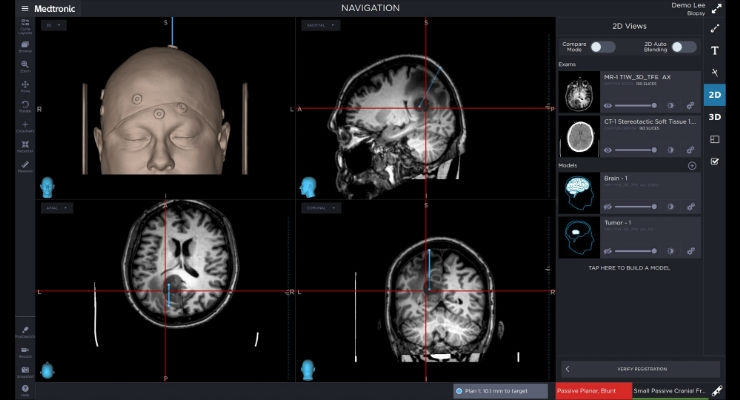 Medtronic Launches Advanced StealthStation for Neurosurgery