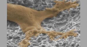 Titanium Surface Technologies Impact the Spinal Fusion Material Debate
