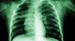 In vivo Models Targeting Respiratory Diseases