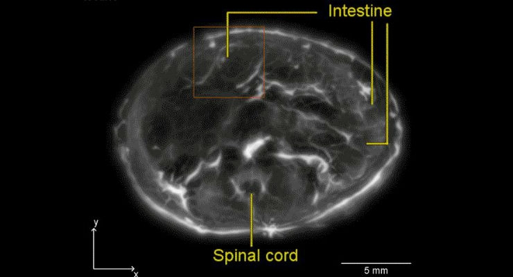 Laser, Sound Waves Provide Live Views of Organs in Action