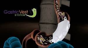 EnteroMedics Acquires the Gastric Vest System