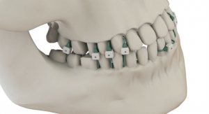 FDA Clears Jaw Fracture Device