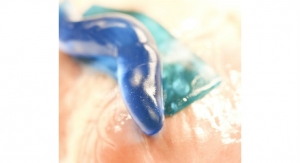 Sticky When Wet: Strong Adhesive for Wound Healing