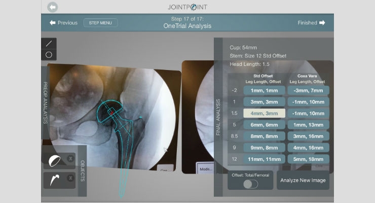 DePuy Synthes & JointPoint to Co-Market Hip Navigation System