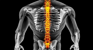 Nanoparticles Limit Damage in Spinal Cord Injury