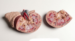 New AI Tech Significantly Boosts Kidney Analysis