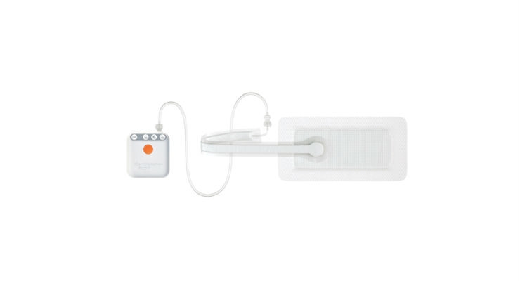 Smith & Nephew Launches New PICO 7 Negative Pressure Wound Therapy System in Europe