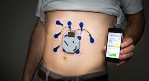Wearable System Monitors Stomach