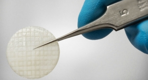 AlloSource and Stryker Launch Cryopreserved Osteochondral Allograft