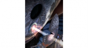 Butterfly Wings Inspire Light-Manipulating Surface for Eye Implants