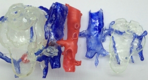 Please Touch: 3D Printed Anatomy Can Make Surgery a Hands-On Experience for Everyone