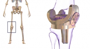Simulations Reveal Role of Calcium in Titanium Implant Acceptance