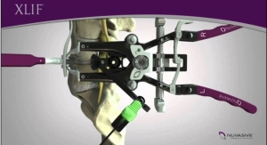 NuVasive Enrolls First Patients in Study Evaluating Advanced Spinal Implants Used in XLIF Procedures