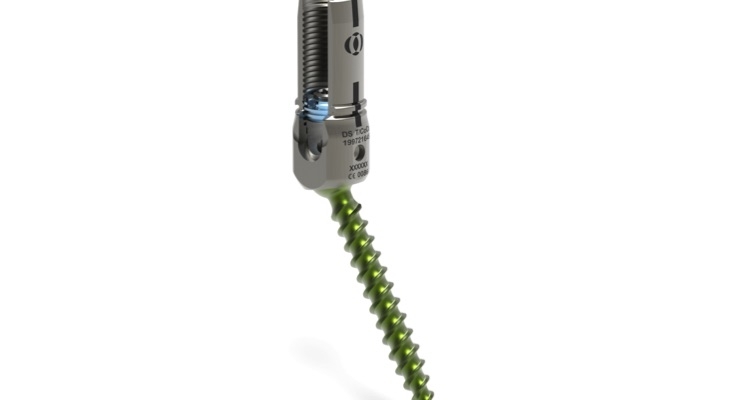 Pedicle Screw System Market Forecast to Grow to $724.2 Million by 2023
