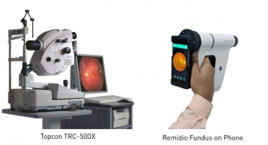 Smartphone-Based Retinal Camera Outperforms Tabletop System in Detecting Diabetic Retinopathy