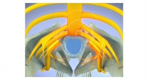  RSNA News: Pulsed Radiofrequency Relieves Acute Back Pain and Sciatica
