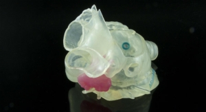 Stratasys and Materialise: 3D Printed Medical Models Come to Life