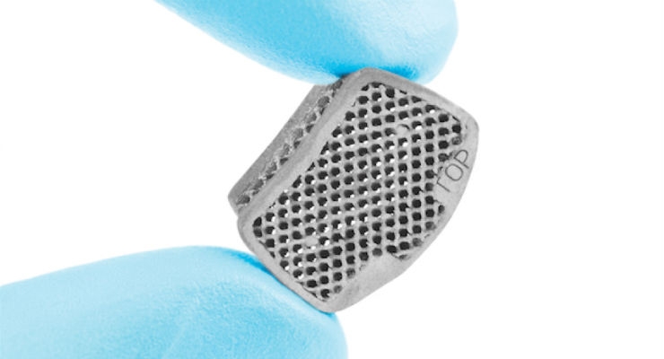 Coupling Personalized Medicine with Metal 3D Printing