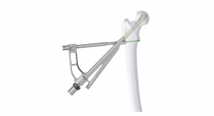 DePuy Synthes Launches Implant Solution for Femoral Neck Fixation 