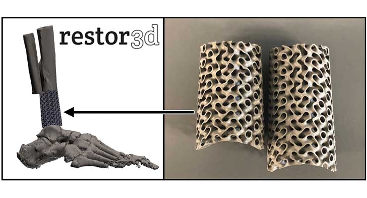 Does 3D Printing Add Value In Orthopedics? - Covering the specialized field  of orthopedic product development and manufacturing