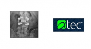 Alphatec Launches TLIF IdentiTi Posterior Curved Porous Titanium Interbody Implant System