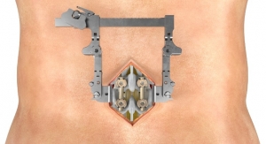 SeaSpine Launches Mariner Midline Posterior Fixation System