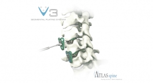 Atlas Spine Launches V3 Guided Segmental Cervical Plating System