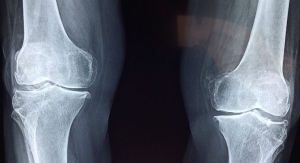 Endonovo Therapeutics, Stanford University Partner on Shoulder and Knee Study