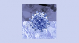 Oxford Immunotec Releases COVID-19 Immune Response Test Kit 