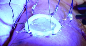 Researchers 3D Print Sensors Directly onto Organs