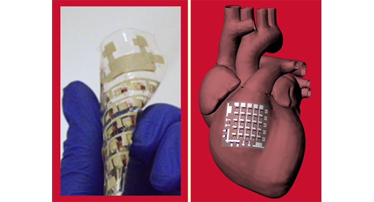 University of Houston: Implantable Device Can Monitor, Treat Heart Disease