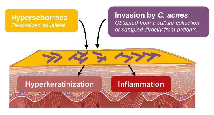 Silab Develops Model of Reconstructed Epidermis