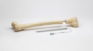 Orthofix Launches FITBONE Limb-Lengthening System in U.S. and Europe