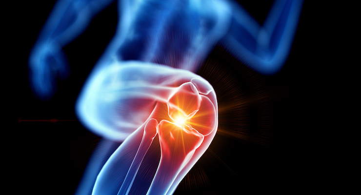 Preliminary Research Suggests Osteoarthritis Benefits for Herbal Formula JointAlive 