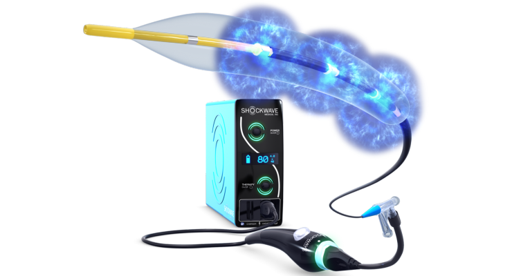 Shockwave Medical’s Sonic Pressure Wave Therapy Receives Pre-Market Approval