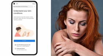 Google Develops AI Tool That Can Help Identify Skin, Hair And Nail Issues |  Beauty Packaging