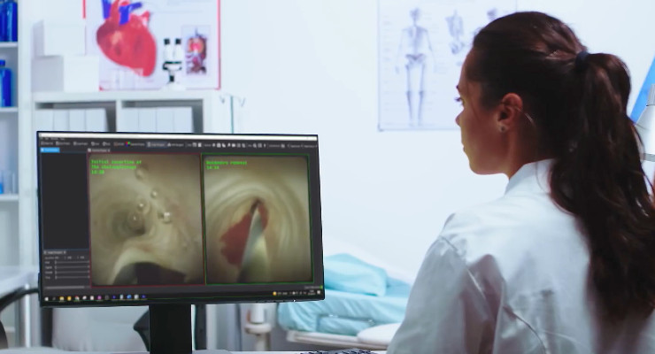 RSIP Vision Offers Real-Time Surgical Workflow Recognition for Robotic Surgery