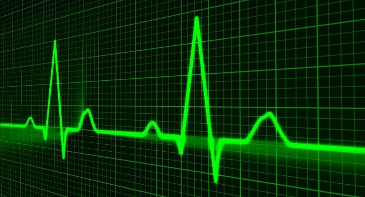 Study: Human Oversight ECG Monitors Outperform AI-Dependent Monitoring 