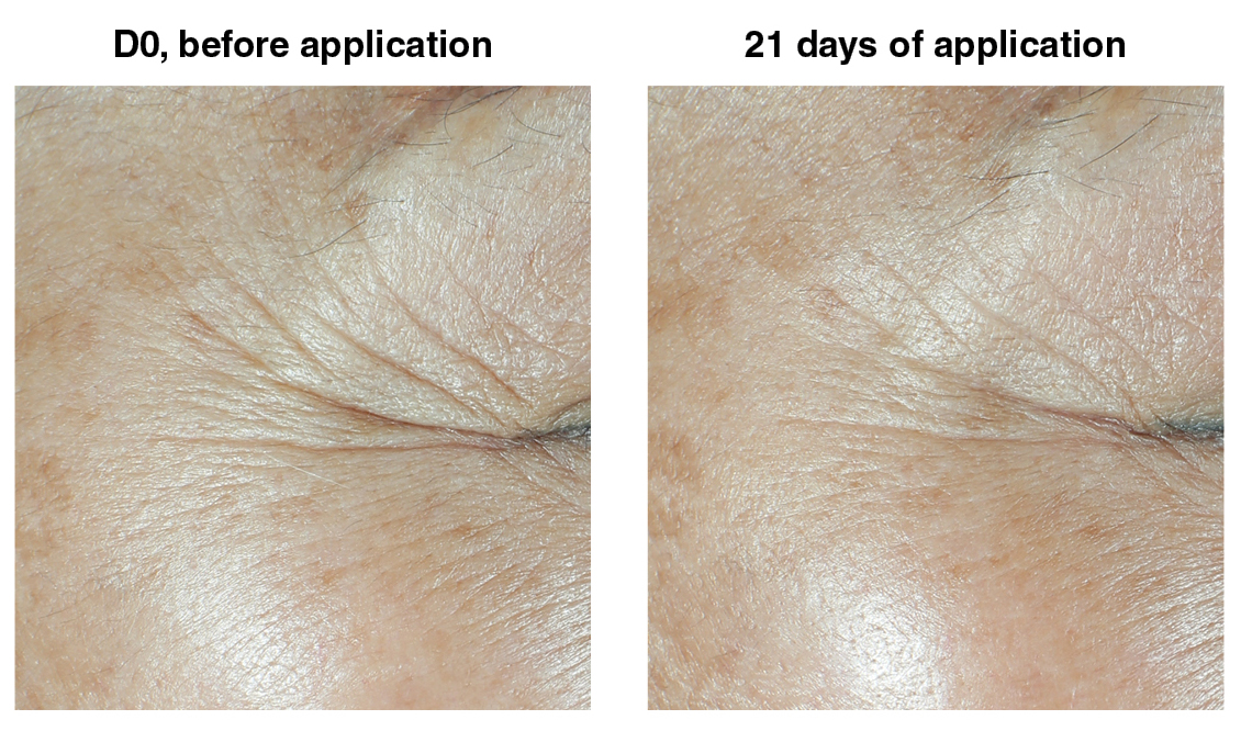 Silab’s New Active Ingredient, Peptilium, Clinically Proven to Reduce Wrinkles in 21 Days