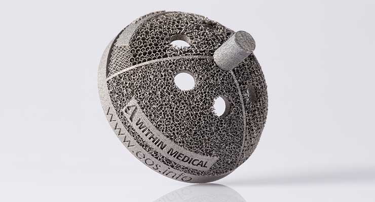 Designing Orthopedic Devices for Additive Manufacturing