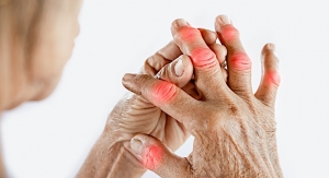 Theramex, Enzene Biosciences Partner on Arthritis Treatment