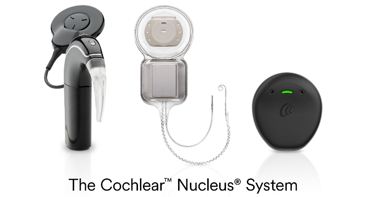 FDA Approves Cochlear Nucleus Implants for UHL/SSD