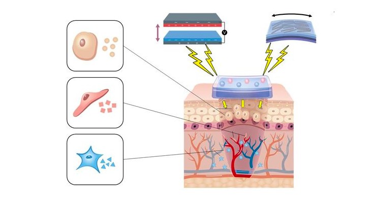 Could Electric Generators Accelerate Wound Healing and Tissue Regeneration?